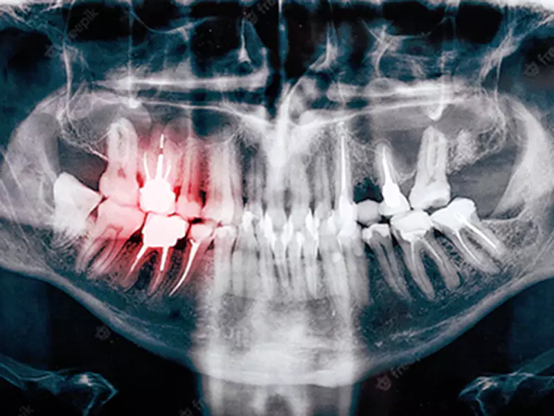 Dental-x-ray-1